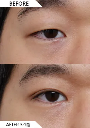 Before