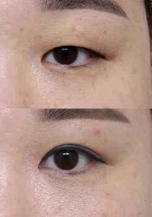 After
