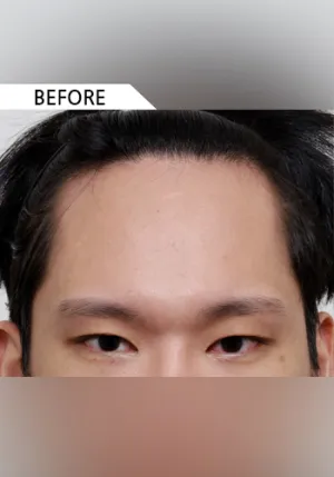 Before