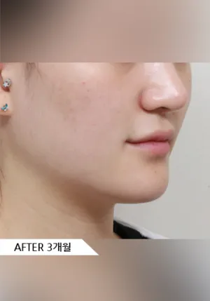 After