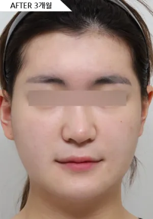 After