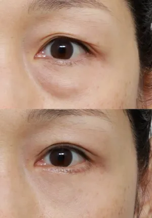 After