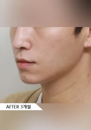 After
