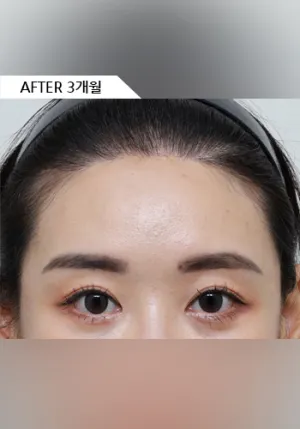 After