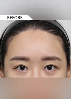 Before