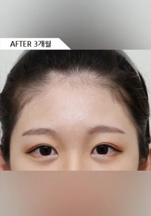 After