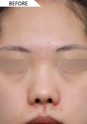 Before