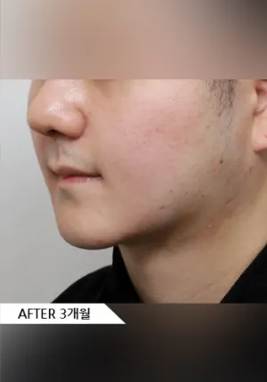 After