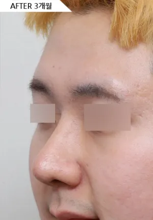 After