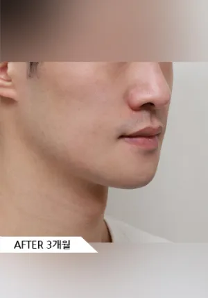 After