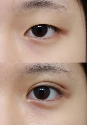 After