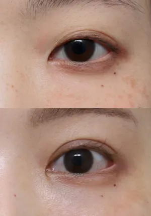 After