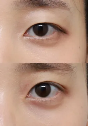 After