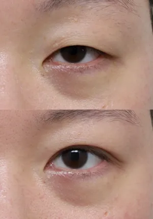 After