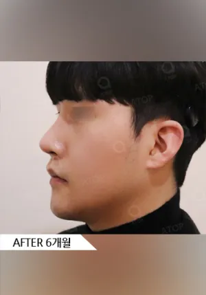 After