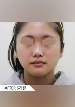 After