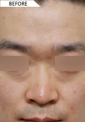 Before
