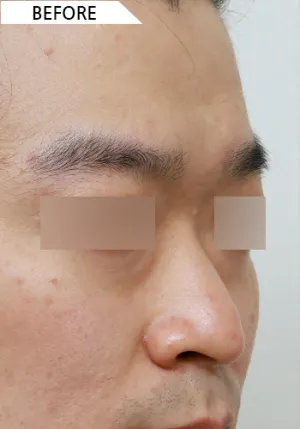 Before
