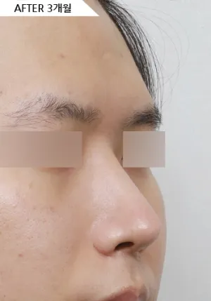 After