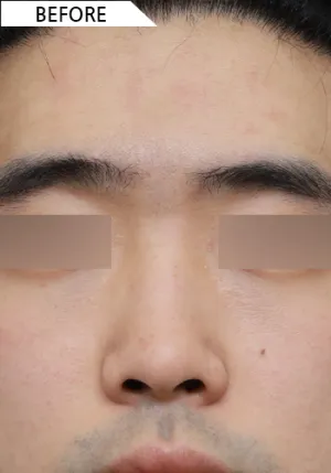 Before