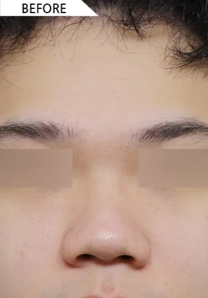 Before