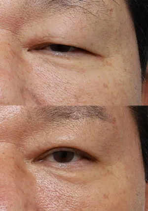 After