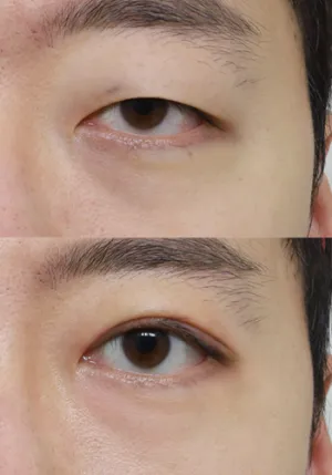 After