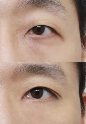 After