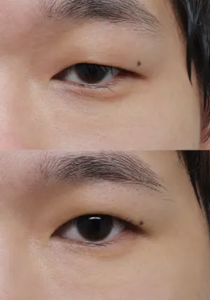 After