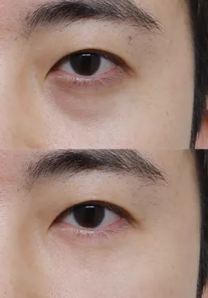 After
