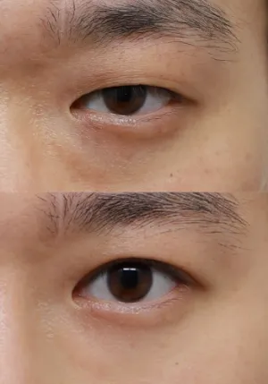 After