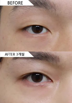 Before