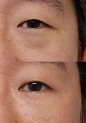 After