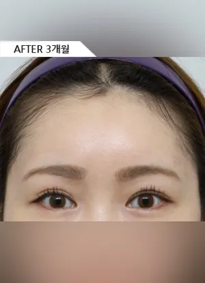 After