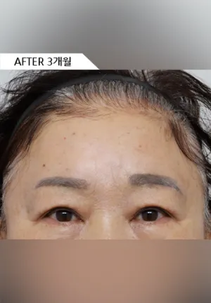 After