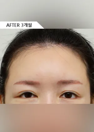 After
