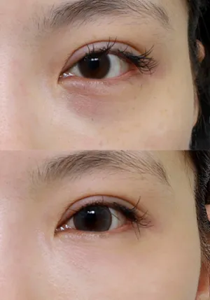After