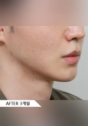 After