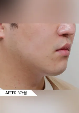 After