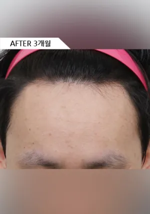 After