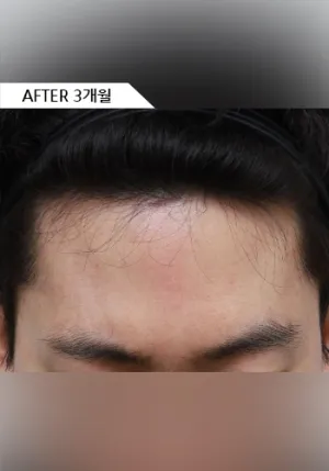After