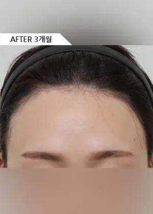 After