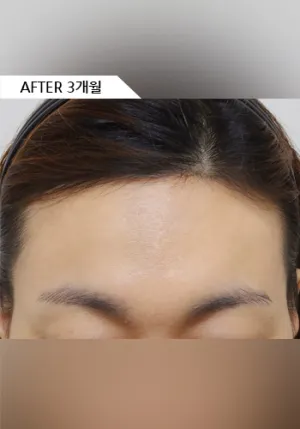 After