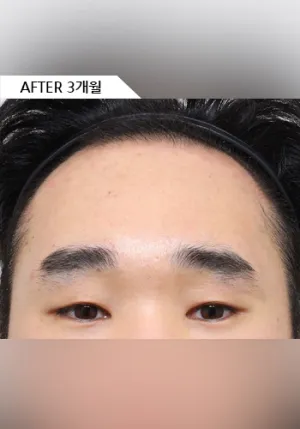 After