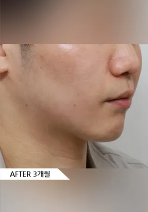 After