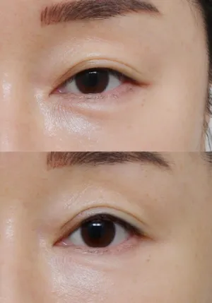 After