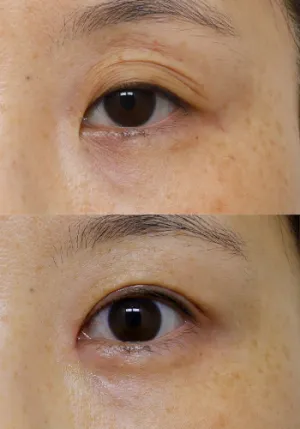 After