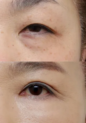 After