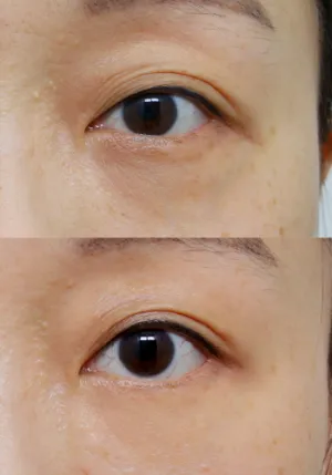 After
