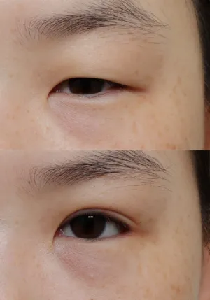 After